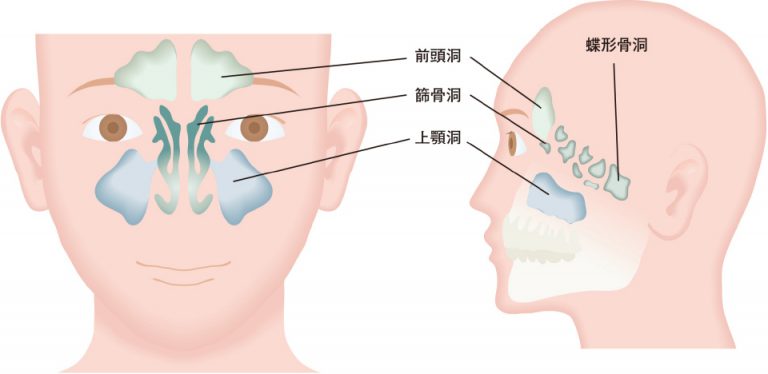 【画像】副鼻腔炎（蓄膿症）